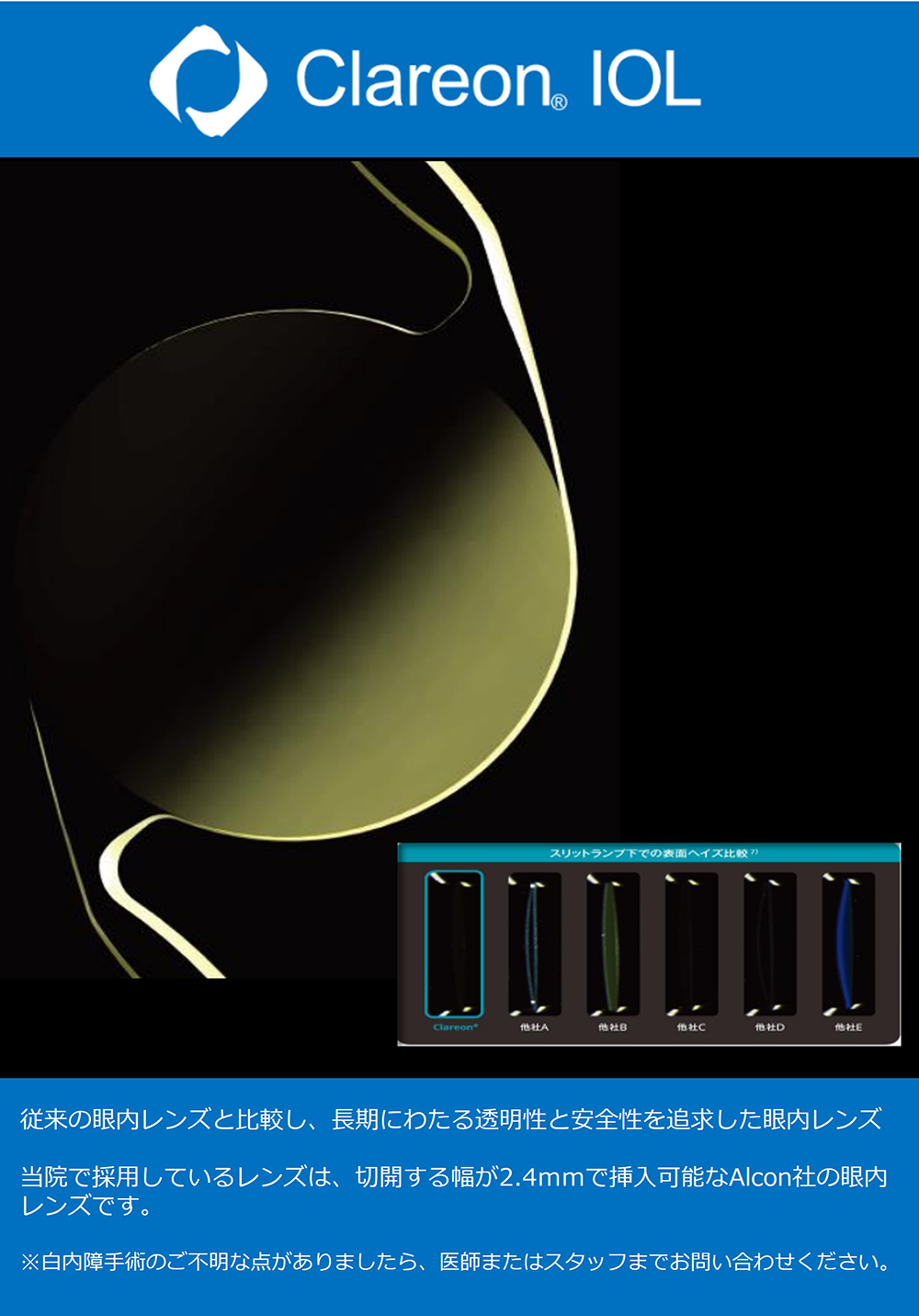 clareonIOL_img