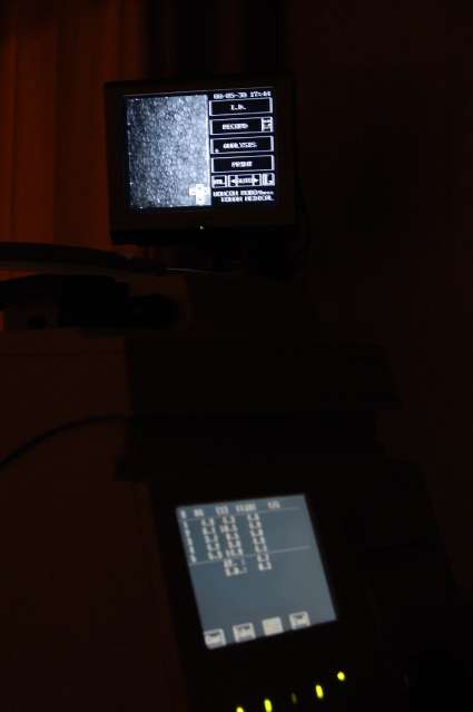 検査（小林直樹眼科）2