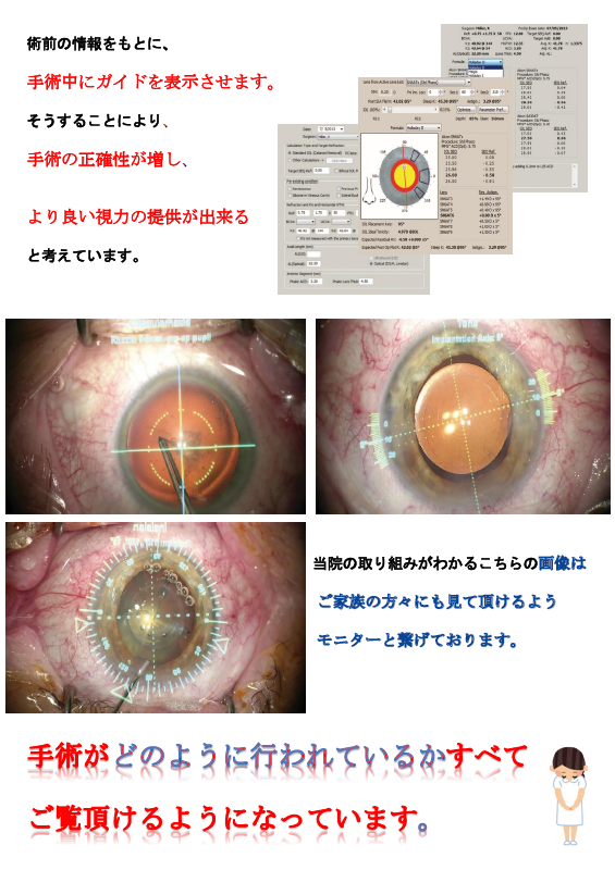 手術・小林直樹眼科2