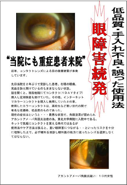カラコン眼障害